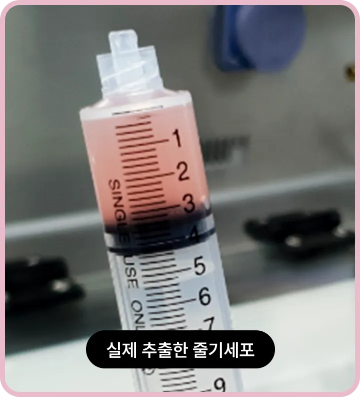 기린 줄기세포 실제 추출한 줄기세포